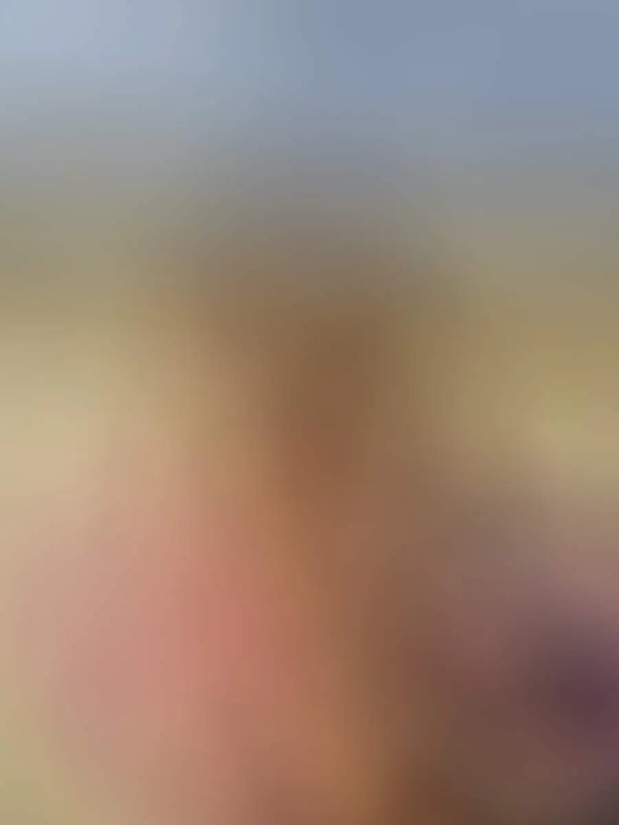 LLdear image 2